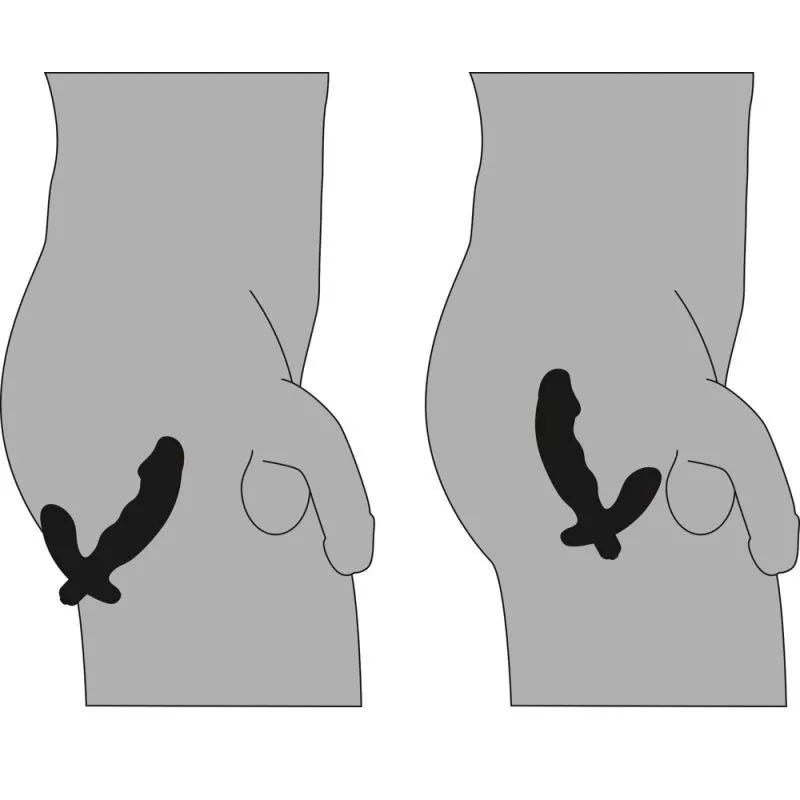 Prostatos masažuoklis Protestas